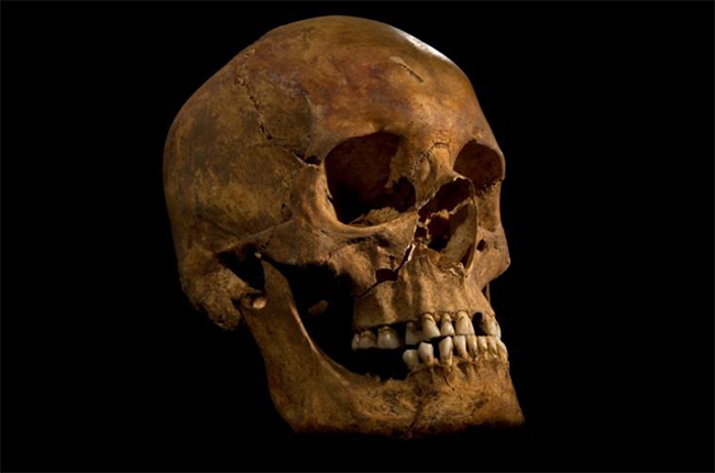 Skull of King Richard III © University of Leicester.