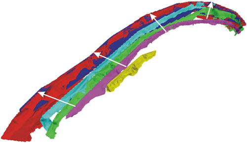 Figure 4 3-D laser scan solid models for 2001 to 2006 at Happisburgh. 2001 is yellow ranging annually to dark blue (2006).