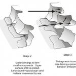 Figure 6 Process model for embayment formation at Happisburgh.