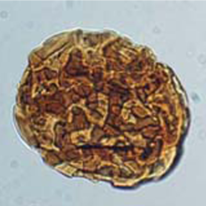 Carboniferous spore Convolutispora major